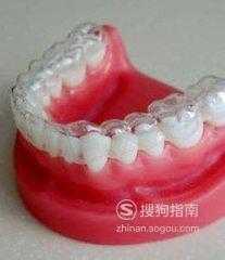 牙齿矫正：[7]带牙套多少钱？我的整牙价格